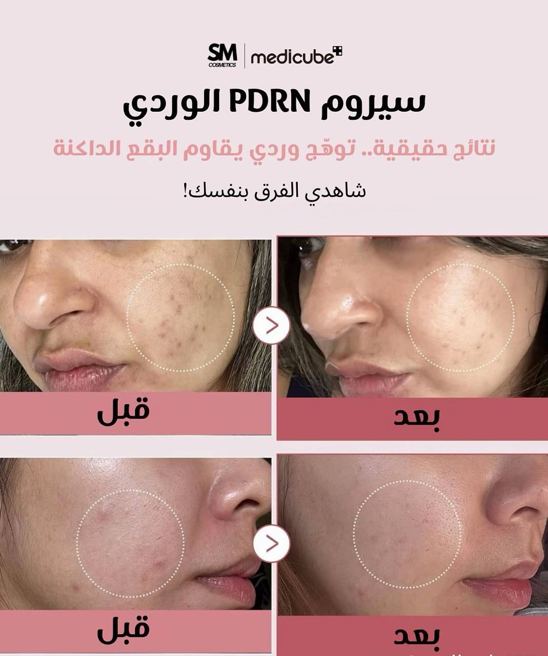 Medicube serum